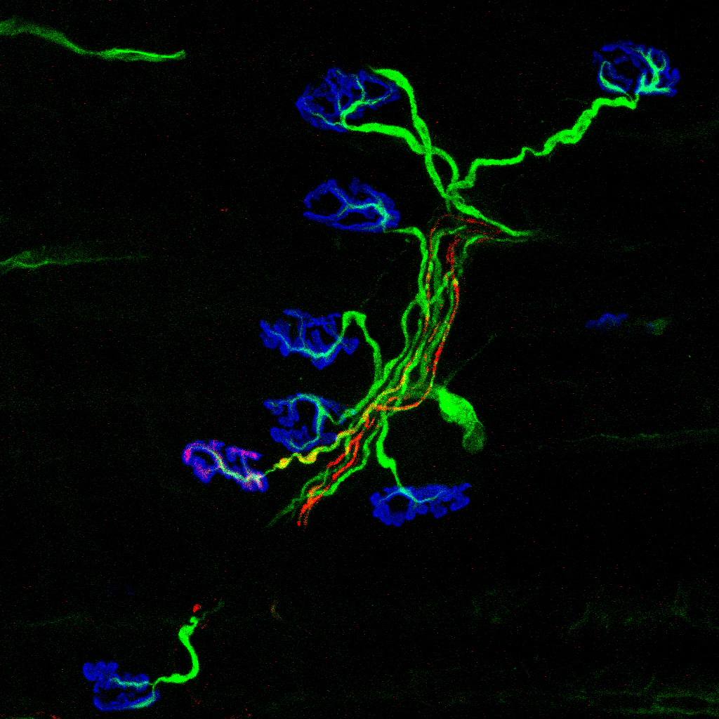microscópio confocal LSM 880 com aquisição em z-stack, objetiva de 63X
