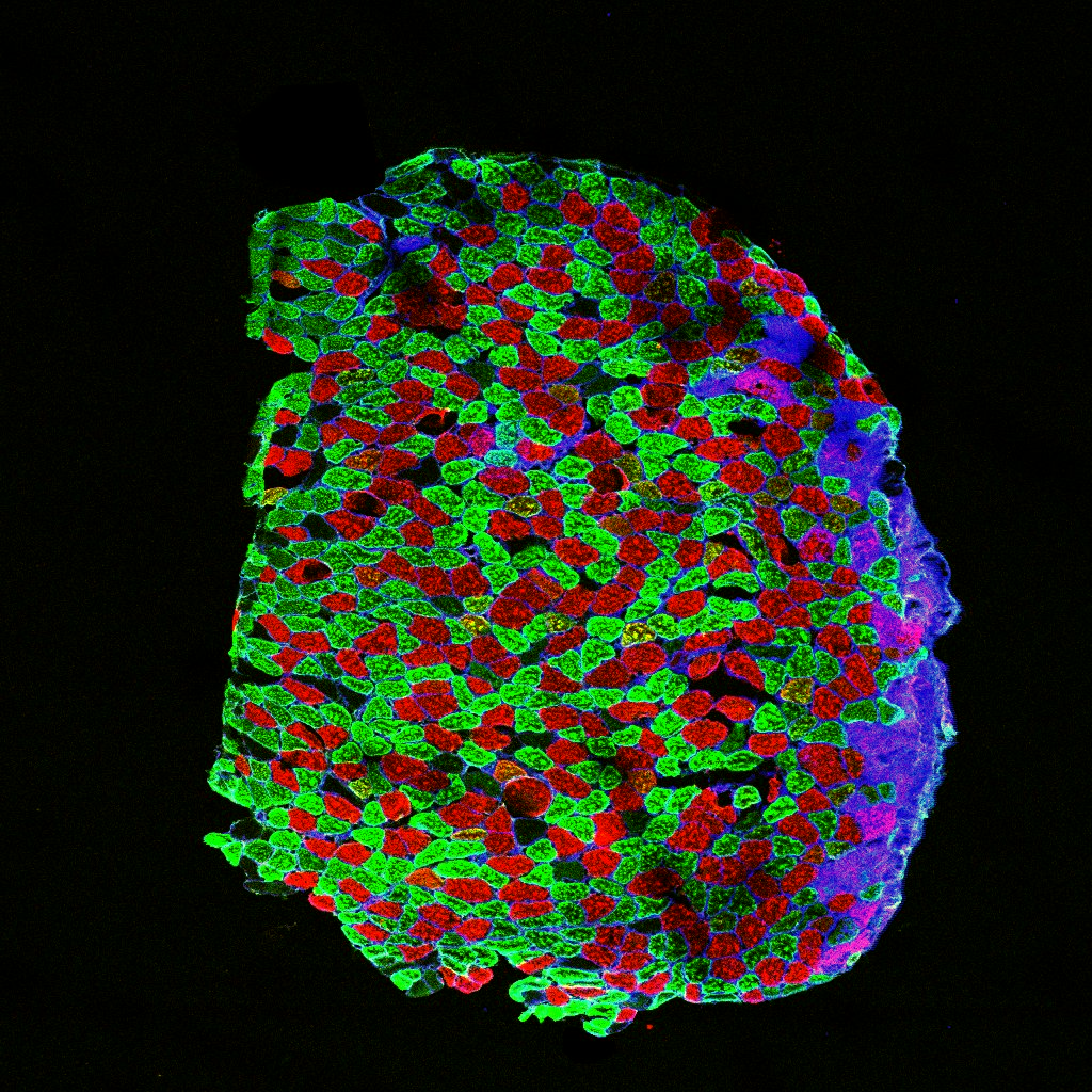 Microscópio Confocal Zeiss LSM 880 (EC Plan-NEOFLUR 10x NA 0,3).